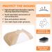 Carbou Sacrum Silicone Foam Dressing 6''x7'' - Waterproof Sacral Pad for Pressure Ulcers - 5 Pack - Buy Online on GoSupps.com