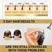 Shampoing au gingembre produits capillaires au gingembre - Anti-chute soin anti-perte de cheveux cheveux pais et plus longs pour la perte de cheveux et l'amincissement des cheveux - Pour homme - Buy Online on GoSupps.com