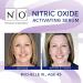 N1O1 Nitric Oxide Activating Serum | Antioxidant-Rich Hydrating Face Serum | Decreases Wrinkles, Minimizes Pores, Improves Skin Texture | 1 Fl Oz - Buy Online on GoSupps.com
