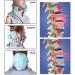 Neck Rescuer: Inflatable Cervical Vertebrae Device for Neck Pain Relief & Correction | Adjustable Neckline Support | Ideal Gift - Buy Online on GoSupps.com