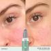 REN Clean Skincare Evercalm Redness Relief Serum 1 Fl Oz - Soothing Serum for Sensitive Skin - Cruelty-Free & Vegan - Buy Online on GoSupps.com