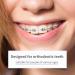 OUMJCING Interdental Brush - Angle Dental Brush Cleaner for Tight Teeth | Tooth Cleaning Tool with Portable Case - Buy Online on GoSupps.com