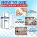 Calculusfree Dissolving Dental Spray - Powerful Dental Calculus Remover & Mouth Refreshing Spray (3 PCs) | Intensive Stain Removal for Clean Teeth - Buy Online on GoSupps.com