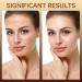 HZENPPOR PDRN Serum Cream 99% Pure Salmon DNA PDRN Advanced Face Moisturizer Cream with Collagen Hyaluronic Acid Niacinamide for Glass Glow Skin Hydration Uneven Skin Tone 20g Unscented - Buy Online on GoSupps.com