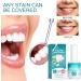 Teeth Paint Teeth Whitening Gel Teeth Whitening Paint Instant Whitening Paint for Teeth Teeth Polish White for Sensitive Teeth (1 - Buy Online on GoSupps.com