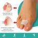 Welnove Toe Spreader & Spacers for Overlapping Toes - Aloe Vera Gel Toe Correction for Hammer Toes - Pain Relief for Men & Women (Medium 8 Pieces) - Transparent - Buy Online on GoSupps.com