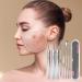 Pimple Popper Tools 8 Curved Blackheadd Remover Tweezers Stainless Steel Pimple Tweezers Kit Blackheadd Removal Kit with Box Blackheadd Remover Tool Kit for Women - Buy Online on GoSupps.com