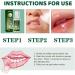 2pcs Mouth Ulcer Spray Mouth Ulcer Treatment Spray Canker Relief Spray Oral Ulcer Sprays Herbal Mouth Spray to Reduce Bad Breath Canker Sore Treatment Ulcer Breath Sprays Mouth Freshener Spray - Buy Online on GoSupps.com