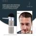 Hair Thickening Fibers - 27.5g - Medium Brown - Keratin Solution for Bald Spots & Thinning Hair - Fast Coverage for Men & Women - Buy Online on GoSupps.com
