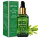 Tea Tree Acne Treatment Serum, Clear Skin Serum for Clearing Severe Acne,Breakout, Remover Pimple and Repair Skin (40ml, 1.41fl oz) 1.4 Fl Oz (Pack of 1)