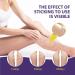 Varicose Vein Relief Cream - Promotes Blood Circulation - 20g - Buy Online on GoSupps.com