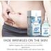 Maternity Skincare Oil Stretch Mark Repair Oil Pregnancy Scar Serums Skin Tightening Oil Pregnancy Stretch Mark Serums Perfect and Suitable Treatments for Adults - Buy Online on GoSupps.com