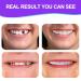 Nature Comfort Fake Teeth Set: Upper & Lower Dentures for Confident Smile - White (2 PCS) - Buy Online on GoSupps.com