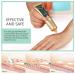 Silicone Scar Ointment 30g - Moisturizing Scar Cream for Smooth, Inconspicuous Scar Removal - Buy Online on GoSupps.com