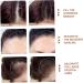 2Pcs Root Touch Up Powder Windproof & Sweatproof Hairline Powder for Women & Wen Natural Stain-Proof Hair Loss Concealer Hairline Powder for Thinning Hairline Black & Brown Black Brown - Buy Online on GoSupps.com