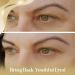 OROGOLD 24K Intensive Eye Serum - Anti Aging Solution for Wrinkles & Puffiness - 50ml - Buy Online on GoSupps.com