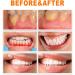 Ampulls Tooth Serum & Gum Repair Essence - Whitening & Repair Cure Ampoules | Shop Internationally - Buy Online on GoSupps.com