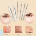 6-in-1 Blackhead Remover Pimple Popper Tool Kit | Acne Blemish Extractor Tweezers Set for Face | Skin Care Tools - Buy Online on GoSupps.com