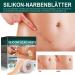 Silicone Scar Sheets (4cm x 150cm) | Professional Treatment for C-Section Burns Keloids & Acne Medication-Free Solution - Buy Online on GoSupps.com