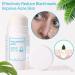 Buy Hyaluronic Oil Control Facial Stick - Cleansing Solid Face Care 40g - International Shipping Available - Buy Online on GoSupps.com