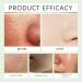 Greteam Purifying Exfoliating Gel Greteam Exfoliating Scrub Purifying Exfoliating Gel Moisturizing Cleanses Skin Give Exfoliating Body and Face Scrub Gel Exfoliating Gel for Dark Neck (2pc) - Buy Online on GoSupps.com