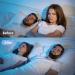 Buy Adjustable Anti Snoring Chin Strap for CPAP Users - Breathable Comfortable & Skin-Friendly | Reduce Snoring Effectively - Buy Online on GoSupps.com