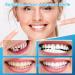 Aiuulu 5 Pairs Pop on Veneers Teeth Set Easy to Use Temporary Snap on Veneers for Women Men Portable Veneers You can Eat with - Buy Online on GoSupps.com