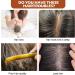PENCHUAN Batana Oil Hair Growth 120 ml (Hair Oil Natural Cold Pressed Rosemary) - Buy Online on GoSupps.com