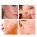 2024 New Acne Cover Patch Spot Stickers for Face & Skin - 36 Patches | Effective Acne Treatment | Fast Shipping Internationally - Buy Online on GoSupps.com