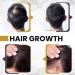 Aphrona Advanced Hair Growth System 272 HairPro - Rechargeable Laser Cap for Hair Regrowth | Clinically Proven, FDA Cleared | Mild to Moderate Hair Loss Solution for Men and Women - Buy Online on GoSupps.com