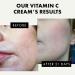 Buy Vitamin C Face Cream - Brightening Moisturizer with 2.5% Hyaluronic Acid & 2% Squalane for Uneven Skin Tone & Wrinkles - Antioxidant Firming Cream International Shipping Available - Buy Online on GoSupps.com