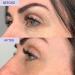 SKINICIAN Ageless Peptide Eye Complex - Anti-Wrinkle Eye Cream with Hyaluronic Acid & Vitamin C - Peptide Serum Eye Cream for Dark Circles - Stimulate Collagen Product - Vegan & Cruelty Free (15ml) - Buy Online on GoSupps.com