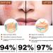 Rosacea Face Serum Anti Redness Face Serum for Women Relieve Redness & Acne Mark Dark Spot Correcting Glow Serum Anti Aging Serum for Face Hydrating Face Serum Skin Care for Women Dark Spots Remover - Buy Online on GoSupps.com