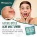 TreeActiv Acne Treatment Face Cream with Salicylic Acid & Tea Tree Oil - 90 Day Supply - Buy Online on GoSupps.com