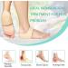 Heel Protectors Heel Cups (4PCS Beige) - Adjustable Breathable Support for Heel Pain, Plantar Fasciitis, Tendinitis, Heel Spur - Women's Heel Cushion for Aching Feet - Buy Online on GoSupps.com