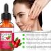 Rosehip Oil for Face 30ml - 100% Pure Organic Cold-Pressed Rose Hip Oil for Skin Body and Hair Natural Rosehip Seed Oil Nourishes and Hydrates for All Skin Types - Buy Online on GoSupps.com