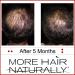 More Hair Naturally 9 - Advanced Stem Cell Therapy for Thinning Hair - Buy Online on GoSupps.com