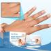 Wart Remover Cream Fast Acting Ointment Anti Corn Cream for Warts Plantar Warts Common Warts Flat Warts Warts for Feet Toe Finger Hands - Buy Online on GoSupps.com