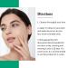 Breylee Tea Tree Oil Serum for Acne Prone/Sensitive Skin - Cystic Acne Treatment, Pimples & Scars Remover, Redness Relief, Niacinamide Moisturizer - Anti-Aging Essence - 30ml/1.01fl oz - Buy Online on GoSupps.com