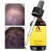 driattie Hair Growth Oil Natural Hair Essence Oil Hair Care Treatments with Concentrated Formula Natural Lightweight Nongreasy Hair Care Strengthens and Repairs Damage Before Use - Buy Online on GoSupps.com