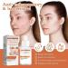 4Pcs Milia Clearing Essence Milia Remover Eye Serum Milia Remover Milia Spot Miliary Repair Essence Moisturize Skin Improve Skin Texture for All Skin Types 30ml/1fl.oz - Buy Online on GoSupps.com