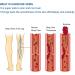 50g Natural Varicose Veins Cream | Leg Circulation & Spider Vein Remover | Cooling Effect | Ointment - Buy Online on GoSupps.com