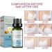 Essential Oil & Plant Extracts - Breast Tightening & Enlarging Massage Oil (3 Pieces) - Anti-Sagging Serum for Lifting Bust - Buy Online on GoSupps.com