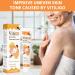 Buy Vitiligo Bee Venom Treatment Cream - Natural Skin Cream for Vitiligo (3PCS) | Effective Topical Solution - Buy Online on GoSupps.com
