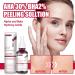 AHA 30% + BHA 2% Peeling Solution - Exfoliating Serum for Blemishes Pore Congestion & Fine Lines | 30ml International Shipping - Buy Online on GoSupps.com