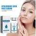 Gla-Mory Micros-Infusions System for Face Gla-Mory Micro-Infusions System for Lips Hyaluronic Acid Serum for Face Smooth Skin Facial Serum Gla-Mory Facial System Hydrating Serum for All Skin 10ml - Buy Online on GoSupps.com