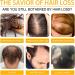 Hair Growth Spray Hair Growth Serum Fast Growing Hair Care Essential Oils Hair Serum for Hair Growth Hair Serum Growth Scalp Spray Anti-Hair Loss Hair Care Oil Hair Growth Serum for Women - Buy Online on GoSupps.com