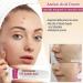 Azelaic Acid for Face Balance Skin Tone & Cleanse Pores Azelaic Acid Serum-Relieve Acne Blackhead & Redness Premium Skin Care 20g (1Pcs) - Buy Online on GoSupps.com