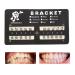 Dental Slot Bondable Brackets Teeth Model Braces Roth Brackets Roth 022 (100 Pcs) - Buy Online on GoSupps.com