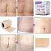 MQUPIN Silicone Scar Tape Roll (1.6 x 60 ) Silicone Scar Sheets Silicone Tape Reusable for C-Section Surgical Scar Keloid Acne Scar and Burn Scar - Buy Online on GoSupps.com